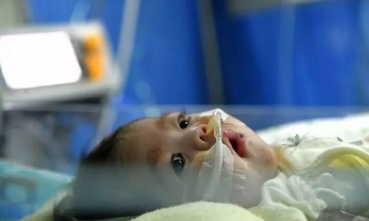 Bé 2 tháng tuổi sống tiếp nhờ trái tim của cậu bé 4 tuổi chết não lấy nước mắt hàng triệu người