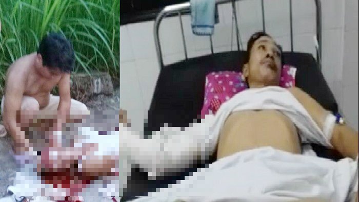 Trên đường đi làm, 2 người bị nhóm côn đồ chém trọng thương ở Hà Nam