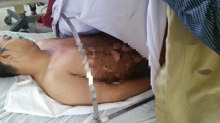 Nam thanh niên cháy như đuốc khi đổ xăng lẻ ven đường ở Huế