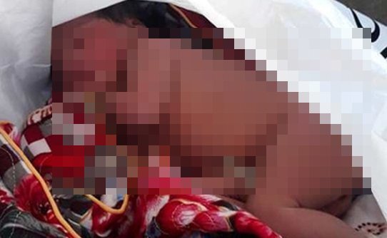 Bé gái còn nguyên dây rốn bọc trong túi nilon bị bỏ rơi trong công viên Nha Trang