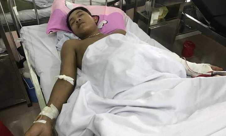 Côn đồ vác kiếm chém thanh niên bán mía gục tại chỗ