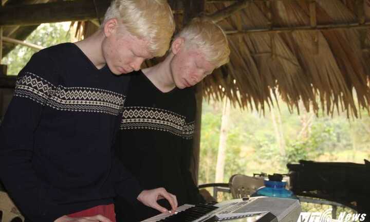 Xúc động ước mơ làm ca sỹ của anh em sinh đôi bị bạch tạng ở vùng rốn lũ Hương Khê