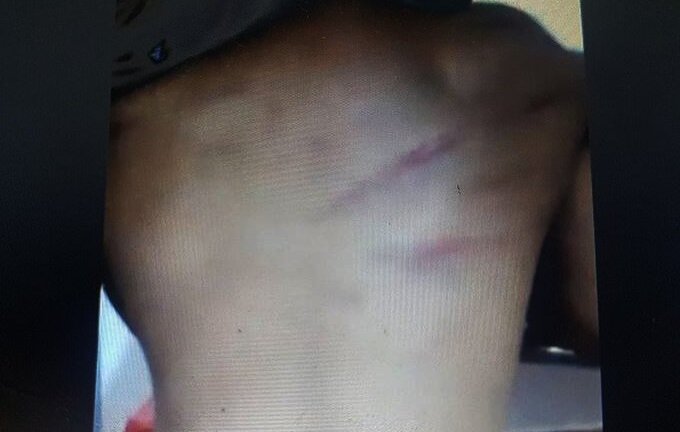 Đánh học sinh bầm lưng ở Hà Tĩnh: Học sinh chuyển trường, cô giáo bị kỷ luật cảnh cáo