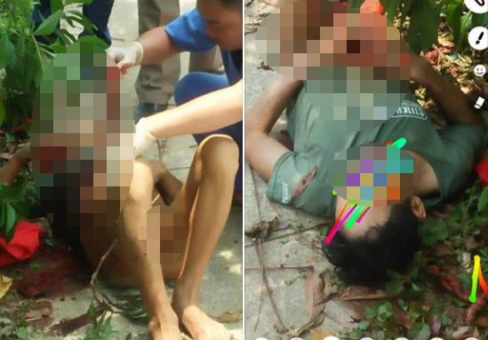 Người đàn ông tự đâm vào bụng nghi do say rượu