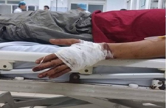 Tranh giành khách, 1 chủ thuyền bị chém trọng thương