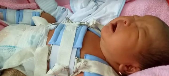 Thông tin mới nhất vụ trẻ sơ sinh bị gãy đùi do bác sỹ mổ đẻ