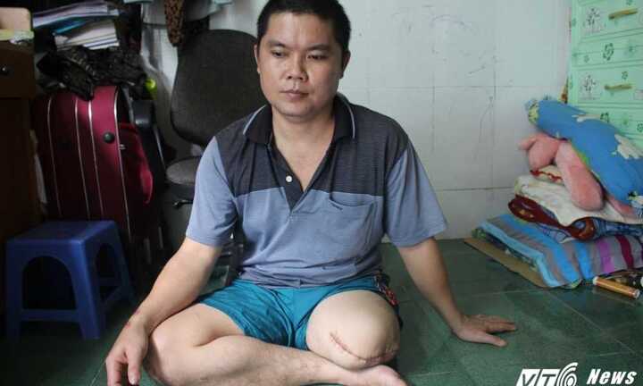 Nam thanh niên bị cưa cụt chân tố bệnh viện tắc trách: Sở Y tế Đồng Nai kết luận thế nào?