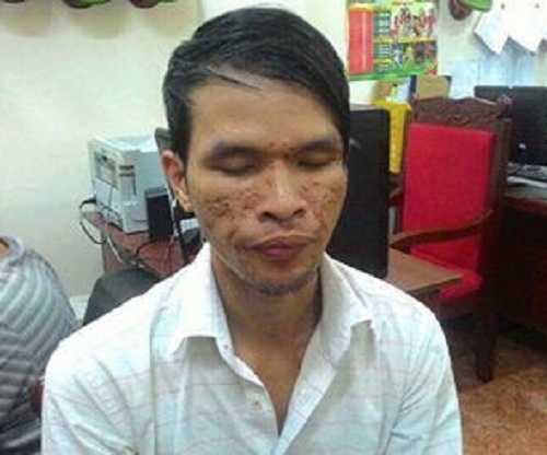 Lời khai của tên bất lương đánh trẻ em dã man bằng roi điện