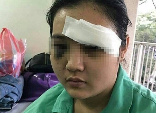 Cô gái bị 20 thanh niên truy sát ở TP.HCM: Nạn nhân có nguy cơ bị mù