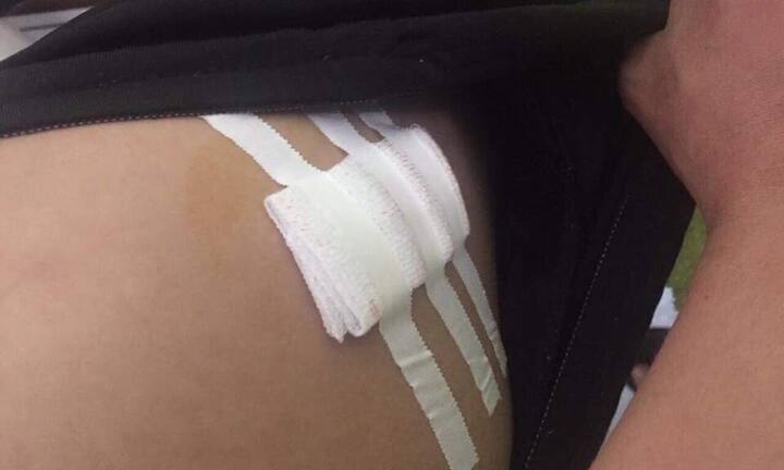 Đi giao hàng, nam thanh niên bị 2 tên cướp đâm trọng thương