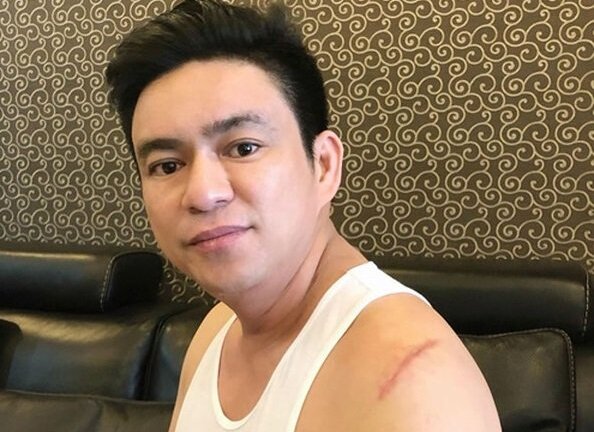 Bác sĩ bị côn đồ tấn công, chém trọng thương ở phố đi bộ Nguyễn Huệ