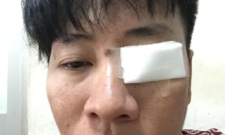 Nhắc nhở tài xế đậu xe trên đường cấm, nam thanh niên bị đánh bầm dập