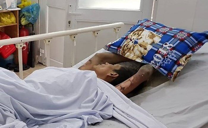 Nam thanh niên nhốt bạn gái, phóng hỏa đốt nhà trọ ở TP.HCM: Thông tin mới nhất