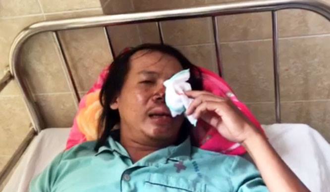 Hiệp sĩ Đồng Nai bị nhóm trộm chó dùng súng điện bắn trọng thương