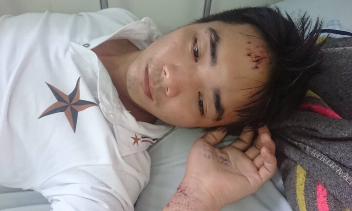 Nam công nhân ở TP.HCM tố bị công an xã còng tay, đánh đập dã man vì nghi lấy trộm giày