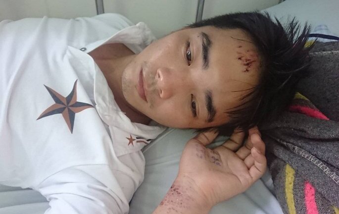 Nam công nhân tố bị công an xã còng tay, đánh đập vì nghi lấy trộm giày: Công an huyện Củ Chi vào cuộc