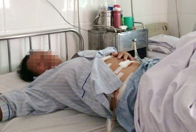 Kinh hoàng hàng trăm viên sỏi lấp đầy túi mật của một nữ bệnh nhân xứ Nghệ