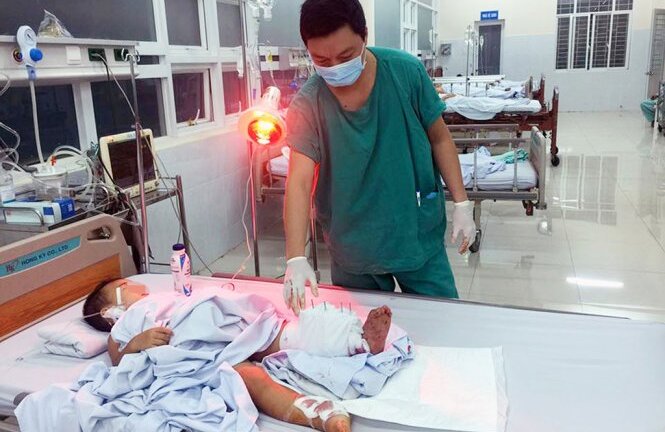 Phẫu thuật thành công, cứu sống bé trai 32 tháng tuổi bị tàu lửa cán đứt lìa cẳng chân
