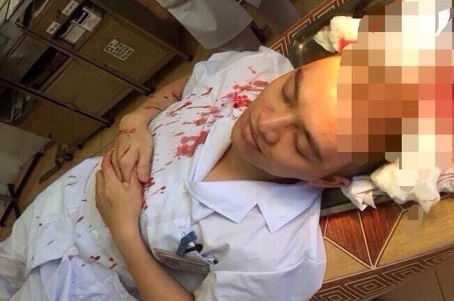 Côn đồ lao vào bệnh viện hành hung bác sĩ: Đòi hỏi y đức, vậy những kẻ côn đồ thì đạo đức gì?