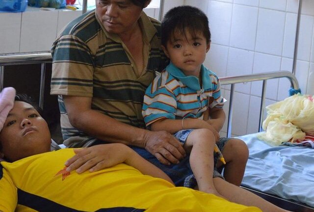 Tìm ra nguyên nhân khiến cậu bé 16 tuổi phải cắt chân sau ngã xe