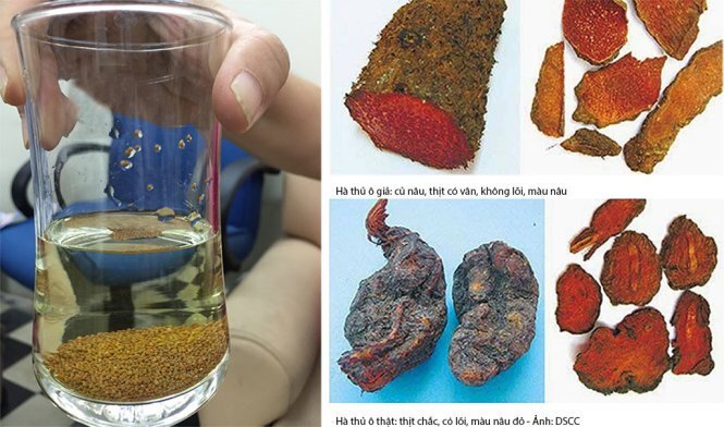 Ngộ độc, suy thận vì cứ uống thuốc nam không rõ nguồn gốc