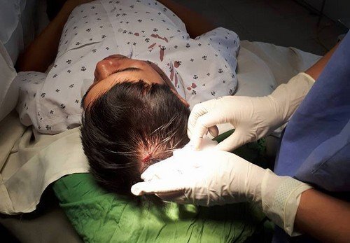 Bác sĩ bị tấn công bằng máy đo huyết áp: Bộ Y tế yêu cầu chấn chỉnh an ninh bệnh viện