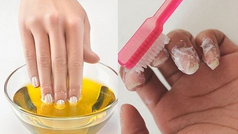 Mách bạn cách khắc phục tình trạng móng tay bị ố vàng cực đơn giản