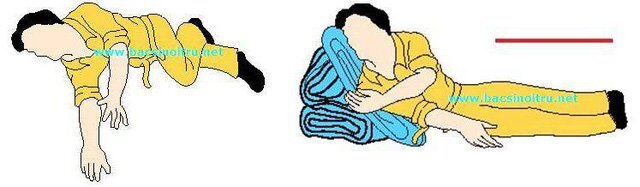 Chuyên gia: Chích máu đầu ngón tay điều trị đột quỵ chỉ là trò lừa bịp