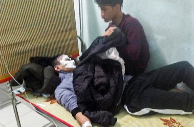 Đốt thử xăng, nam sinh 16 tuổi bị bỏng nặng