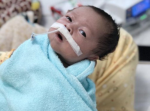 Bé trai bị thủng ruột từ trong bụng mẹ được cứu sống kỳ diệu