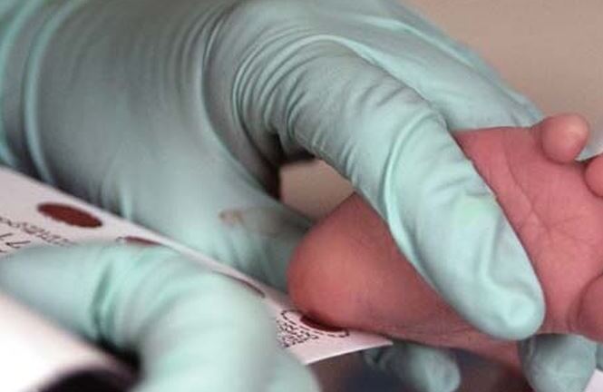 Kỳ lạ căn bệnh trẻ ăn vào là hôn mê, tử vong