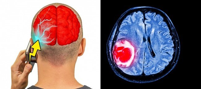 Khoa học chứng minh sóng di động ảnh hưởng tới não ra sao?