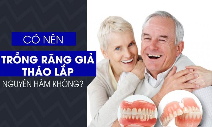 Có nên trồng răng giả tháo lắp nguyên hàm không?
