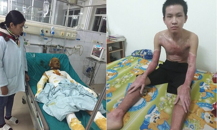 Sự sống hồi sinh với tấm thẻ màu xanh