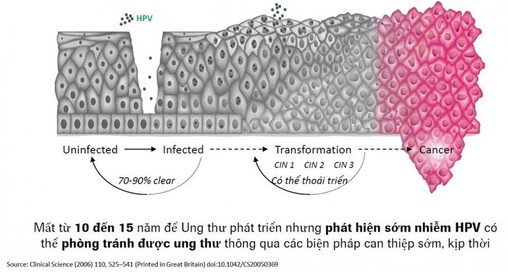 HPV DNA: Xét nghiệm đầu tay trong tầm soát ung thư cổ tử cung được ứng dụng rộng rãi trên toàn cầu