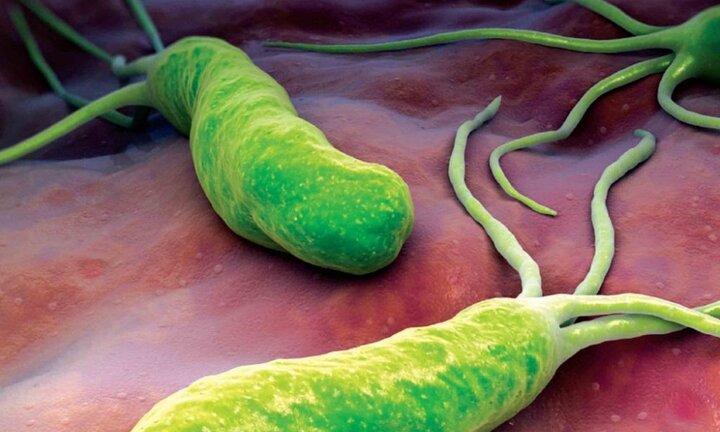 Cách phòng tránh lây nhiễm khuẩn HP