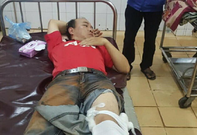 Truy bắt gỗ lậu, phó hạt kiểm lâm bị xe đè nhập viện cấp cứu
