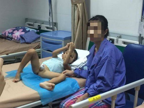 Quảng cáo thổi phồng, lạm dụng cắt bao quy đầu cho trẻ