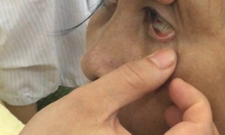 Chưa có vắc xin, dịch sốt xuất huyết hoành hành