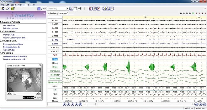 Giải mã các rối loạn giấc ngủ bằng phương pháp đa ký