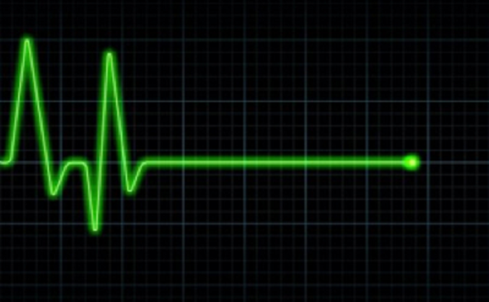 Vì sao con người bị đột tử?