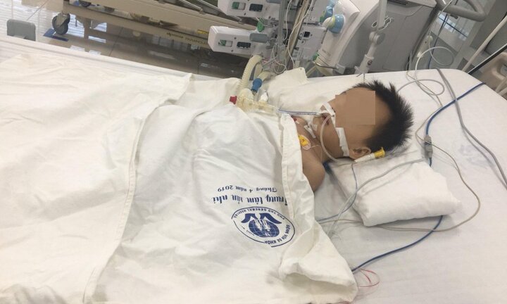 Bé trai 27 tháng tuổi nguy kịch nghi do uống thuốc hạ sốt quá liều