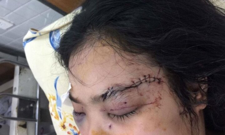 Cô gái bị 20 thanh niên truy sát, cắt tai: Giao Bộ Công an vào cuộc