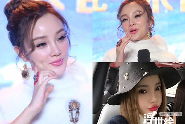 Dàn mỹ nhân mặt biến dạng vì tiêm botox quá đà
