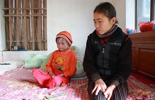 Thiếu niên 17 năm chống chọi với căn bệnh y học không thể chữa khỏi