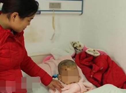 Bé trai 5 tuổi phải khâu 38 mũi do bị chó ngao Tây Tạng tấn công