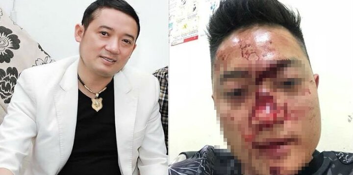 Thực hư thông tin danh hài Chiến Thắng thuê người đánh đập khán giả