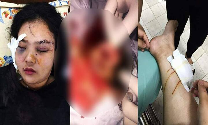 Thiếu nữ bị 20 thanh niên truy sát, cắt tai: Nhiều tình tiết bất ngờ