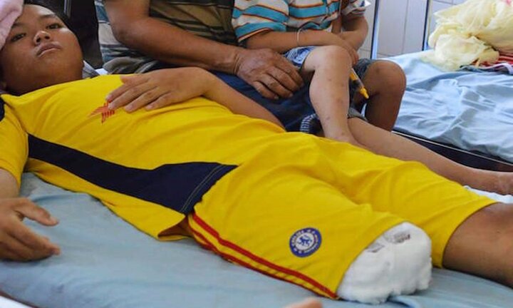 Thanh niên 16 tuổi bị cắt 'oan' 1/3 chân do bệnh viện thiếu chuyên môn