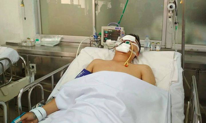 Say xỉn, nam thanh niên rồ ga tông chiến sĩ CSGT nguy kịch